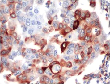 Immunohistochemistry (Formalin/PFA-fixed paraffin-embedded sections) - Anti-RPS6 (phospho S235 + S236) antibody [SP50] - BSA and Azide free (AB236224)