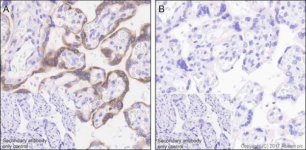 Immunohistochemistry (Formalin/PFA-fixed paraffin-embedded sections) - Anti-RPS6 (phospho S240 + S244) antibody [EPR20770] (AB215214)