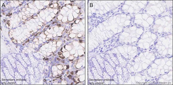 Immunohistochemistry (Formalin/PFA-fixed paraffin-embedded sections) - Anti-RPS6 (phospho S240 + S244) antibody [EPR20770] (AB215214)