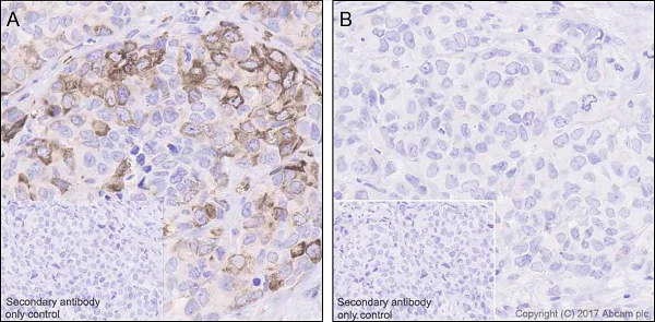 Immunohistochemistry (Formalin/PFA-fixed paraffin-embedded sections) - Anti-RPS6 (phospho S240 + S244) antibody [EPR20770] - BSA and Azide free (AB225578)