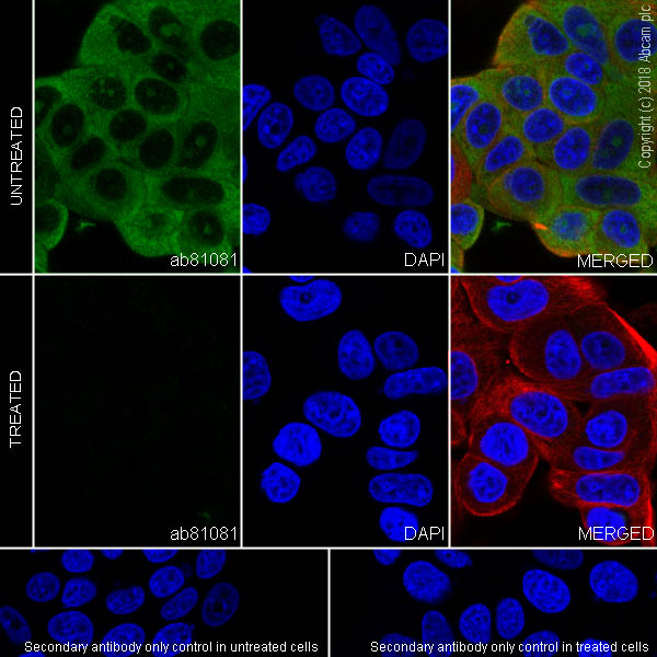 Immunocytochemistry/ Immunofluorescence - Anti-RPS6 (phospho S240 + S244) antibody [SP45] (AB81081), expandable thumbnail