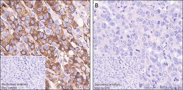 Immunohistochemistry (Formalin/PFA-fixed paraffin-embedded sections) - Anti-RPS6 (phospho S240 + S244) antibody [SP45] (AB81081), expandable thumbnail