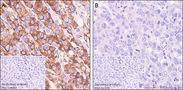 Immunohistochemistry (Formalin/PFA-fixed paraffin-embedded sections) - Anti-RPS6 (phospho S240 + S244) antibody [SP45] - BSA and Azide free (AB236438)