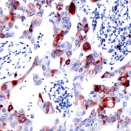 Immunohistochemistry (Formalin/PFA-fixed paraffin-embedded sections) - Anti-RPS6 (phospho S240 + S244) antibody [SP45] - BSA and Azide free (AB236438)
