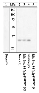 Western blot - Anti-RPS6 (phospho S244 + S247) antibody (AB12865)