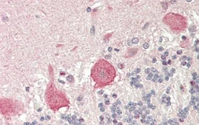 Immunohistochemistry (Formalin/PFA-fixed paraffin-embedded sections) - Anti-RPS7 antibody (AB230862)