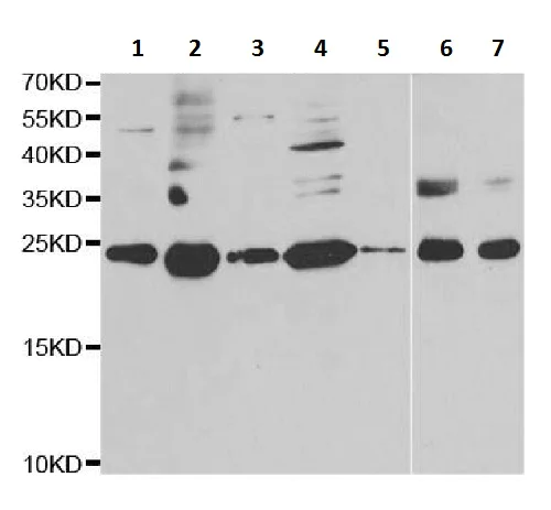 Western blot - Anti-RPS7 antibody (AB230862)