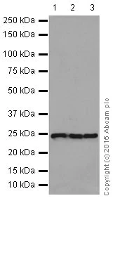 Western blot - Anti-RPS8 antibody [EPR17334] (AB201454)