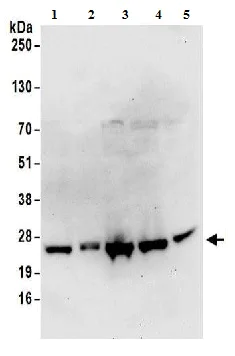 Western blot - Anti-RPS9 antibody (AB157125)