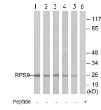 Western blot - Anti-RPS9 antibody (AB74711)