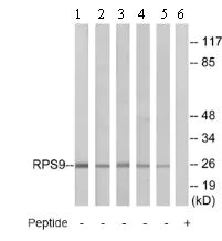 Western blot - Anti-RPS9 antibody (AB74711)