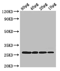 Western blot - Anti-rpsB antibody (AB193293)