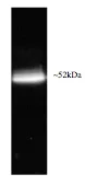 Western blot - Anti-Rpt1 antibody (AB22678)