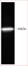 Western blot - Anti-Rpt5/TBP-1 antibody (AB22676)