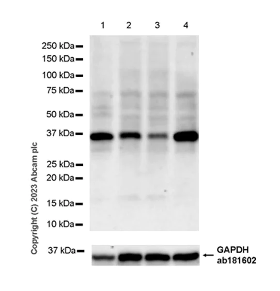 Western blot - Anti-RPUSD4 antibody [EPR26285-12] - BSA and Azide free (AB315327)
