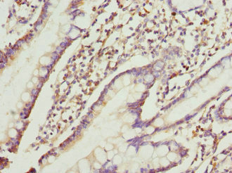 Immunohistochemistry (Formalin/PFA-fixed paraffin-embedded sections) - Anti-RRAGC antibody (AB230184), expandable thumbnail
