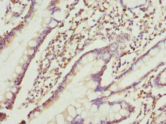 Immunohistochemistry (Formalin/PFA-fixed paraffin-embedded sections) - Anti-RRAGC antibody (AB230184)