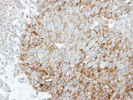 Immunohistochemistry (Formalin/PFA-fixed paraffin-embedded sections) - Anti-RRAS antibody (AB154962), expandable thumbnail
