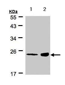Western blot - Anti-RRAS antibody (AB154962), expandable thumbnail