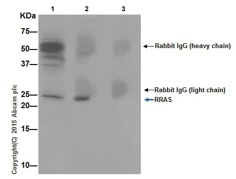Immunoprecipitation - Anti-RRAS antibody (AB191791)