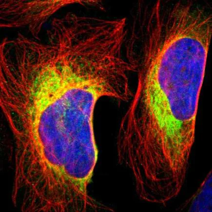 Immunocytochemistry/ Immunofluorescence - Anti-RRBP1 antibody (AB224354)