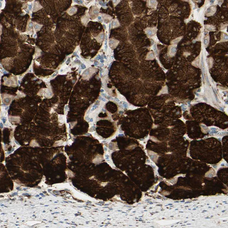 Immunohistochemistry (Formalin/PFA-fixed paraffin-embedded sections) - Anti-RRBP1 antibody (AB224354)