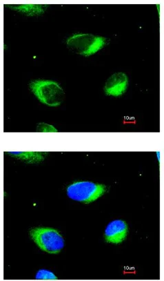 Immunocytochemistry/ Immunofluorescence - Anti-RRBP1 antibody (AB95983)