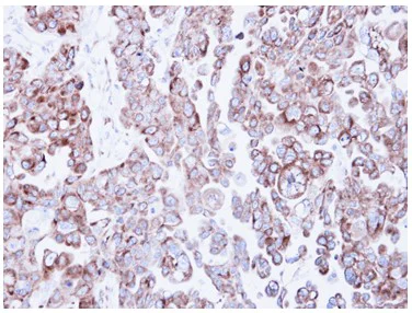 Immunohistochemistry (Formalin/PFA-fixed paraffin-embedded sections) - Anti-RRBP1 antibody (AB95983)