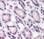 Immunohistochemistry (Formalin/PFA-fixed paraffin-embedded sections) - Anti-RREB1 antibody (AB64168), expandable thumbnail