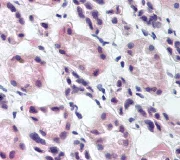 Immunohistochemistry (Formalin/PFA-fixed paraffin-embedded sections) - Anti-RREB1 antibody (AB64168)