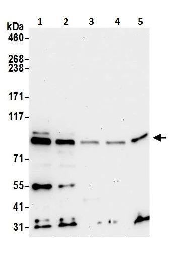 Western blot - Anti-RRM1 antibody (AB226391)