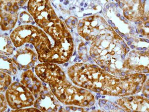 Immunohistochemistry (Formalin/PFA-fixed paraffin-embedded sections) - Anti-RRM1 antibody [EPR8482] (AB133690)