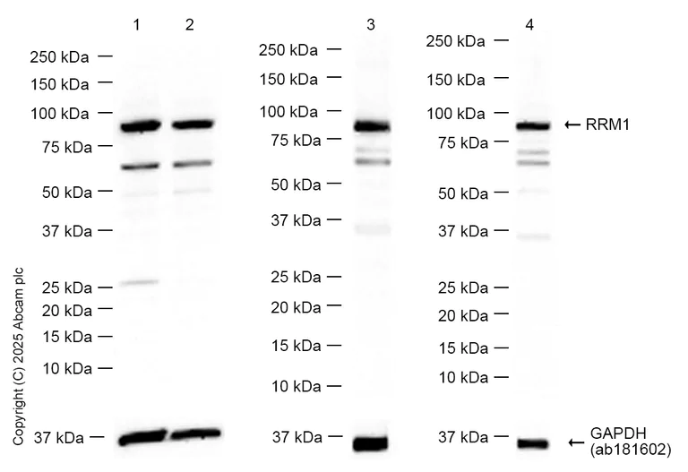 Western blot - Anti-RRM1 antibody [EPR8482] (AB133690)