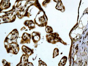 Immunohistochemistry (Formalin/PFA-fixed paraffin-embedded sections) - Anti-RRM1 antibody [EPR8482] - BSA and Azide free (AB248620)