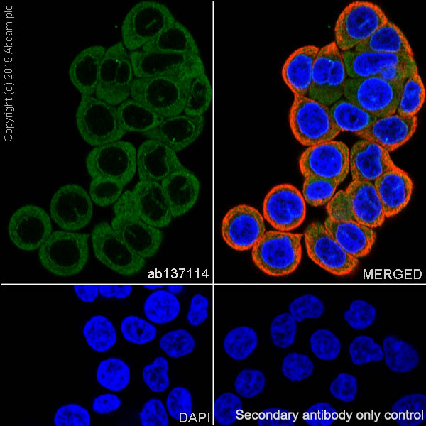 Immunocytochemistry/ Immunofluorescence - Anti-RRM1 antibody [EPR8483] (AB137114), expandable thumbnail
