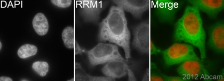 Immunocytochemistry/ Immunofluorescence - Anti-RRM1 antibody [EPR8483] (ab137114), expandable thumbnail
