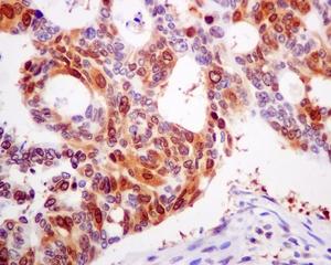 Immunohistochemistry (Formalin/PFA-fixed paraffin-embedded sections) - Anti-RRM1 antibody [EPR8483] (AB137114), expandable thumbnail