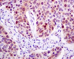 Immunohistochemistry (Formalin/PFA-fixed paraffin-embedded sections) - Anti-RRM1 antibody [EPR8483] (ab137114), expandable thumbnail