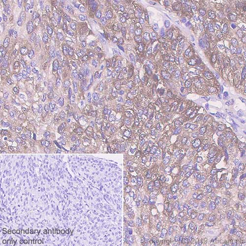 Immunohistochemistry (Formalin/PFA-fixed paraffin-embedded sections) - Anti-RRM1 antibody [EPR8483] (AB137114), expandable thumbnail
