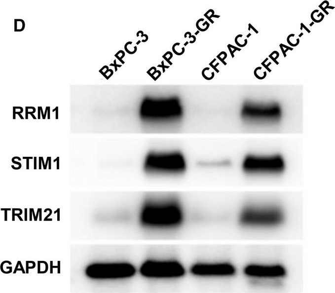 Western blot - Anti-RRM1 antibody [EPR8483] (ab137114), expandable thumbnail