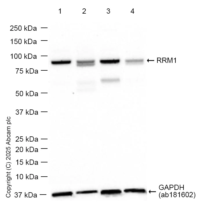 Western blot - Anti-RRM1 antibody [EPR8483] (AB137114)
