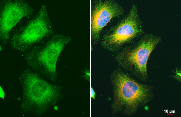 Immunocytochemistry/ Immunofluorescence - Anti-RRM1 antibody [HL1231] (ab308348), expandable thumbnail