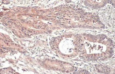 Immunohistochemistry (Formalin/PFA-fixed paraffin-embedded sections) - Anti-RRM1 antibody [HL1231] (AB308348), expandable thumbnail