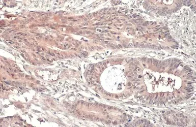 Immunohistochemistry (Formalin/PFA-fixed paraffin-embedded sections) - Anti-RRM1 antibody [HL1231] (AB308348)