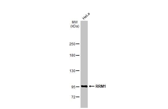 Western blot - Anti-RRM1 antibody [HL1231] (AB308348), expandable thumbnail