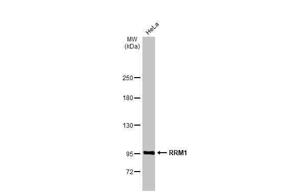Western blot - Anti-RRM1 antibody [HL1231] (AB308348)