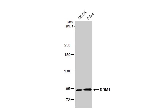 Western blot - Anti-RRM1 antibody [HL1231] (AB308348), expandable thumbnail