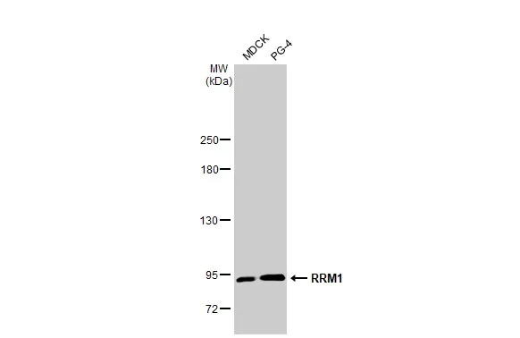 Western blot - Anti-RRM1 antibody [HL1231] (AB308348)