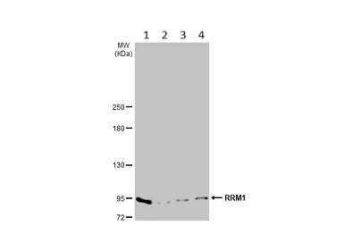 Western blot - Anti-RRM1 antibody [HL1231] (AB308348), expandable thumbnail