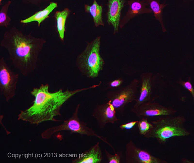 Immunocytochemistry/ Immunofluorescence - Anti-RRM1 antibody [SP167] (AB135383)